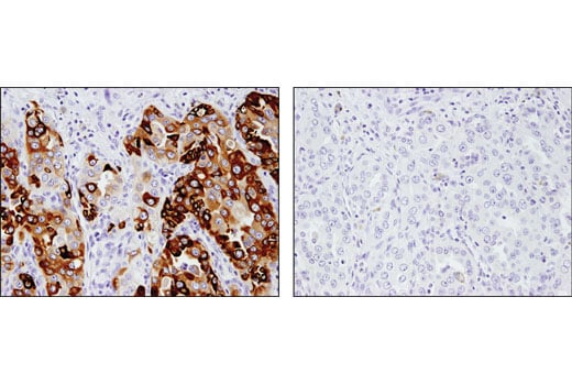 Immunohistochemistry Image 2: AGR2 (D9V2F) XP<sup>®</sup> Rabbit mAb (BSA and Azide Free)