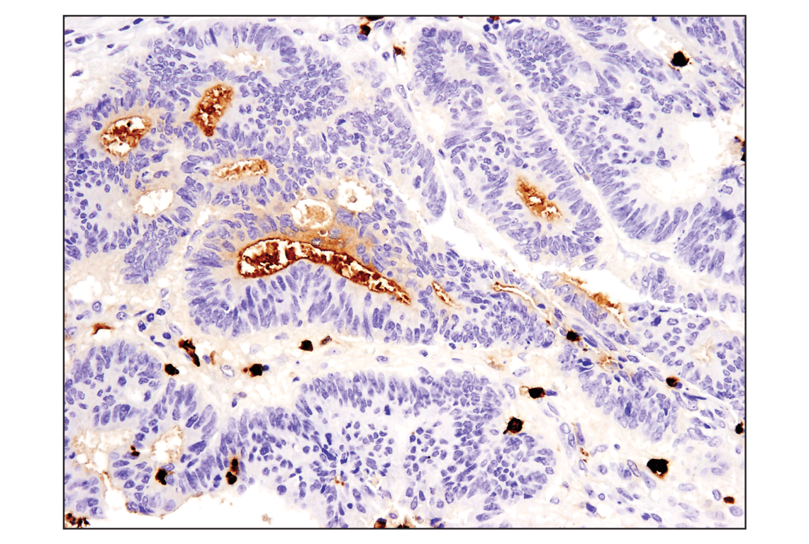Immunohistochemistry Image 1: S100A9 (D5O6O) Rabbit mAb (BSA and Azide Free)