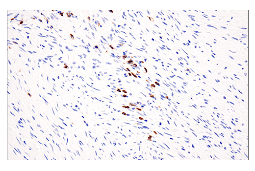 Immunohistochemistry Image 3: CD20 (E7B7T) XP<sup>®</sup> Rabbit mAb
