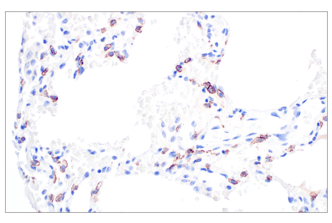 Immunohistochemistry Image 7: CD44 v5 (C44Mab-3) Mouse mAb