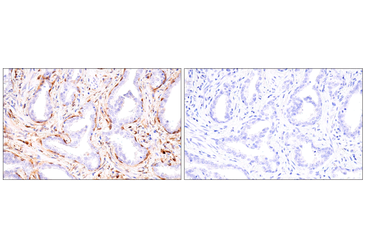 Immunohistochemistry Image 3: α-Synuclein (E4U2F) XP<sup>®</sup> Rabbit mAb (BSA and Azide Free)