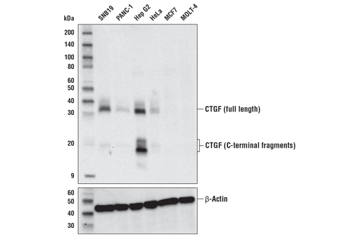 Western Blotting Image 1: CTGF (E2W5M) Rabbit mAb