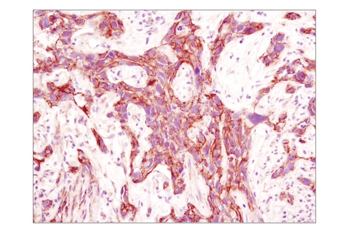 undefined Image 43: Cadherin-Catenin Antibody Sampler Kit