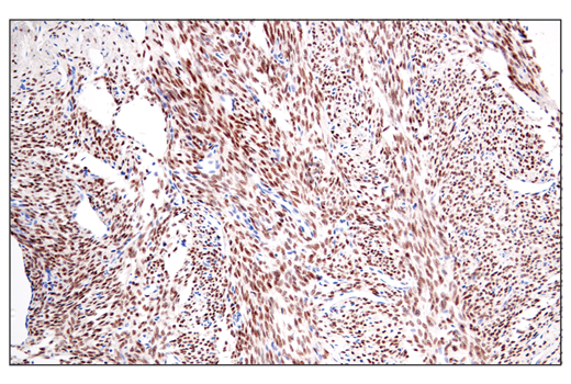 undefined Image 30: BAF Complex IHC Antibody Sampler Kit