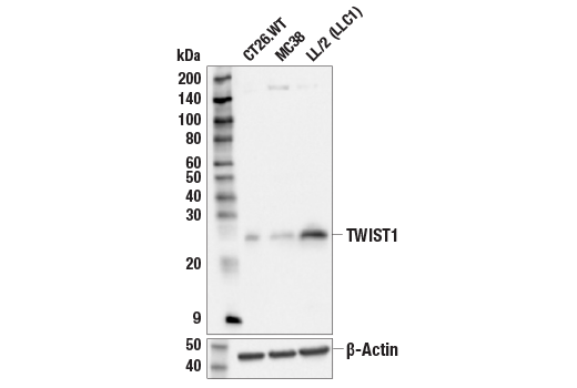 undefined Image 70: Epithelial-Mesenchymal Transition (EMT) IF Antibody Sampler Kit
