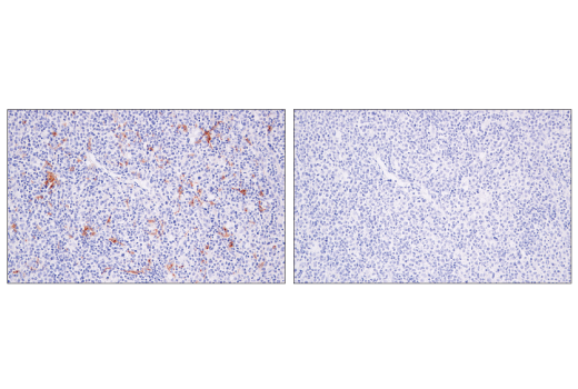 Immunohistochemistry Image 5: XCR1 (D2F8T) Rabbit mAb (BSA and Azide Free)