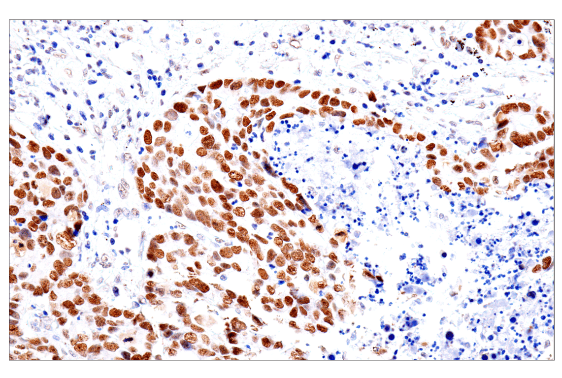 Immunohistochemistry Image 6: FoxA1/HNF3α (IHC578) Mouse mAb