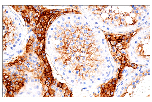 undefined Image 23: SARS-CoV-2 Virus-Host Interaction Antibody Sampler Kit