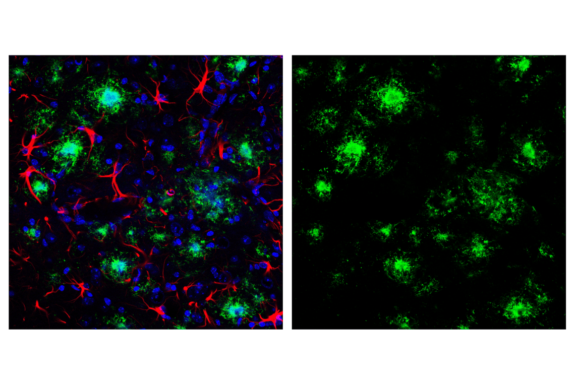 Immunofluorescence Image 1: β-Amyloid (1-42) (E6D5M) Rabbit mAb