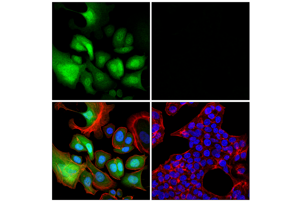 Immunofluorescence Image 1: S100A8 (F4R2W) Rabbit mAb (BSA and Azide Free)