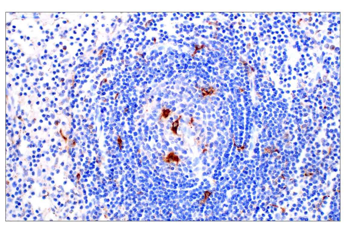 Immunohistochemistry Image 6: Cathepsin D (E5V4H) Rabbit mAb