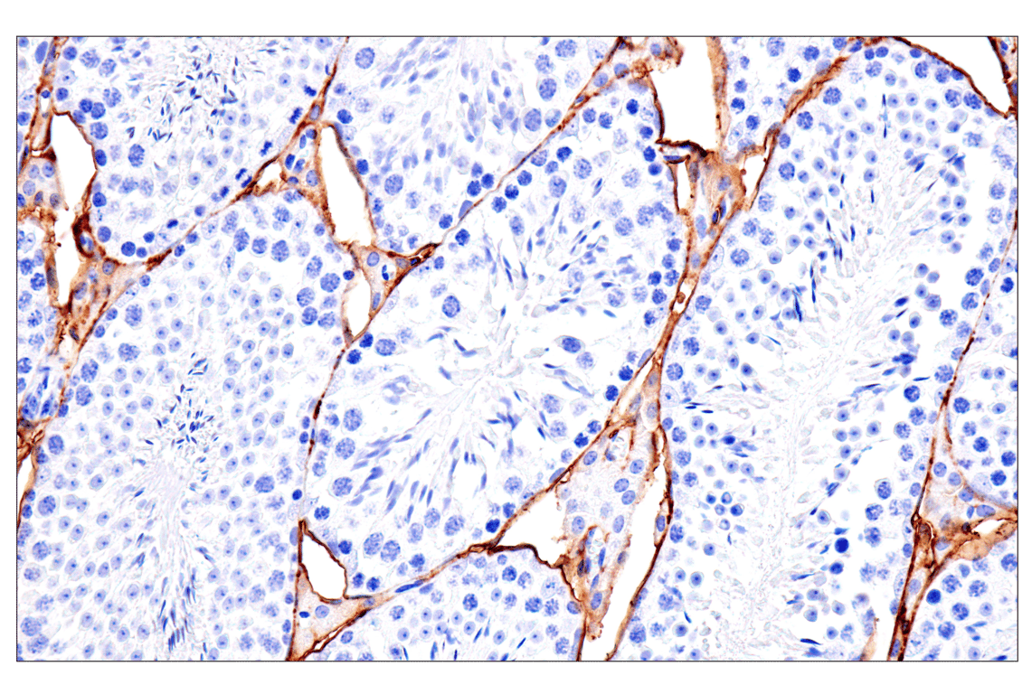 Immunohistochemistry Image 1: DPEP-1/MDP (E5H7T) Rabbit mAb