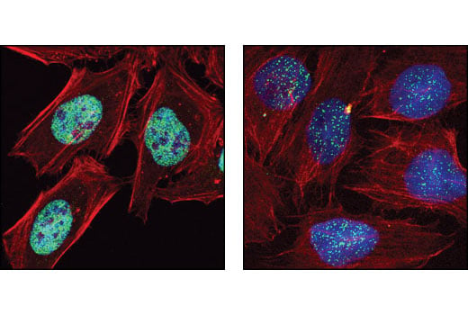 Immunofluorescence Image 1: SET8 (C18B7) Rabbit mAb