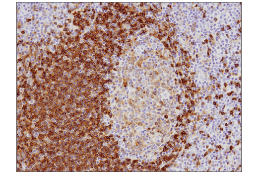 Immunohistochemistry Image 2: CD79B (D7V2F) Rabbit mAb
