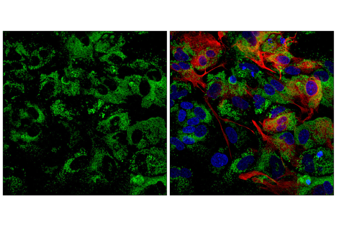 undefined Image 39: PICALM Signaling Antibody Sampler Kit