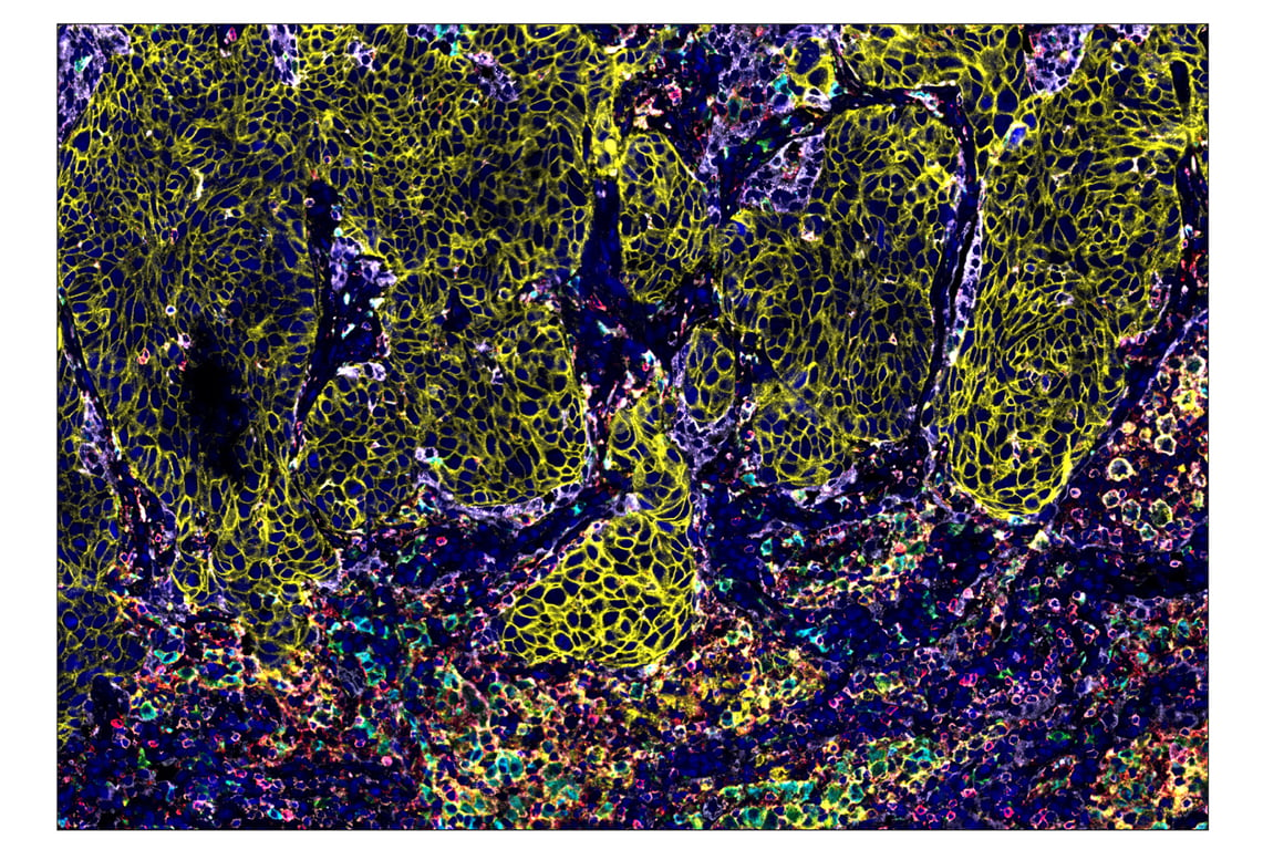 Immunohistochemistry Image 1: CD163 (D6U1J) & CO-0022-488 SignalStar<sup>™</sup> Oligo-Antibody Pair