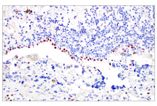Immunohistochemistry Image 3: POU2F3 (E5N2D) XP<sup>®</sup> Rabbit mAb