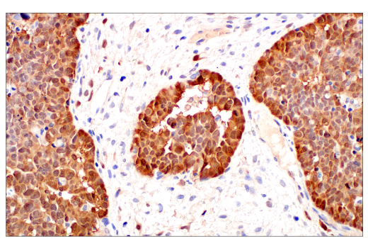 Immunohistochemistry Image 4: p16 INK4A (BC42) Mouse mAb