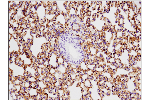 Immunohistochemistry Image 2: VISTA (D5L5T) XP<sup>®</sup> Rabbit mAb