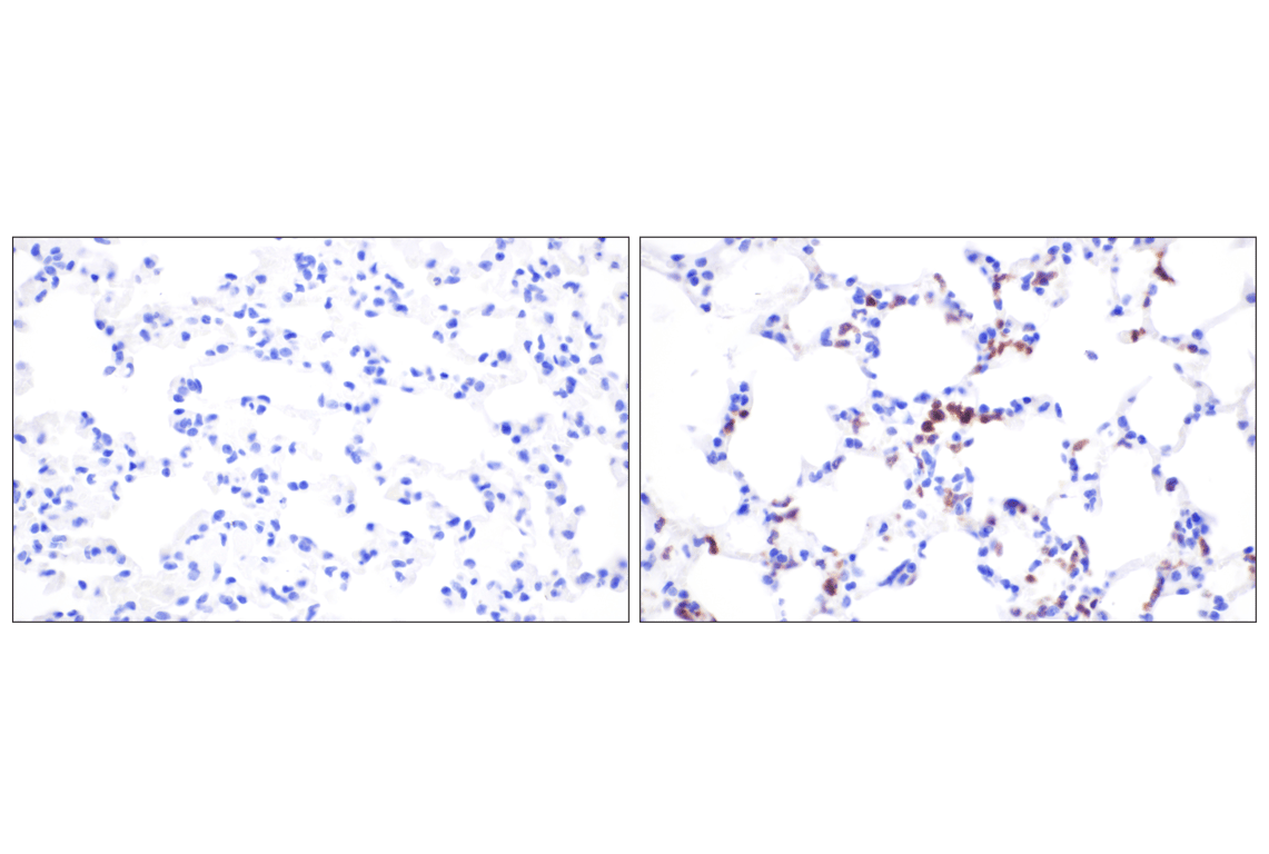 undefined Image 21: Mouse Reactive Pyroptosis Antibody Sampler Kit
