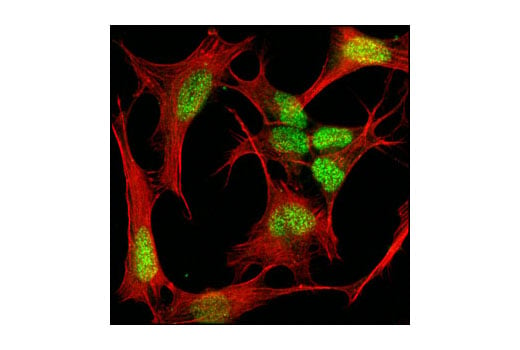 Immunofluorescence Image 1: MeCP2 (D4F3) XP<sup>®</sup> Rabbit mAb (BSA and Azide Free)