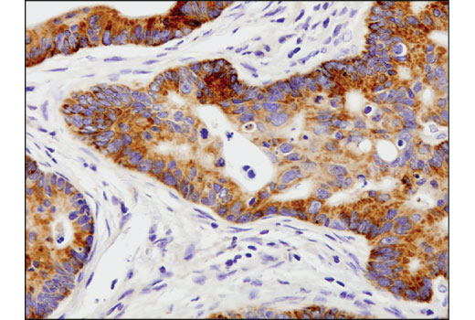 Immunohistochemistry Image 2: FGF Receptor 2 (D4L2V) Rabbit mAb (BSA and Azide Free)
