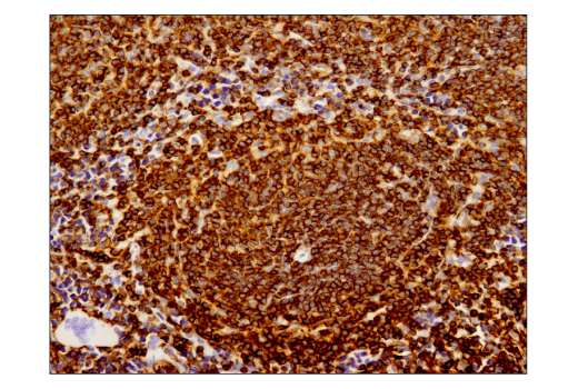 Immunohistochemistry Image 1: CD45 (D3F8Q) Rabbit mAb (BSA and Azide Free)