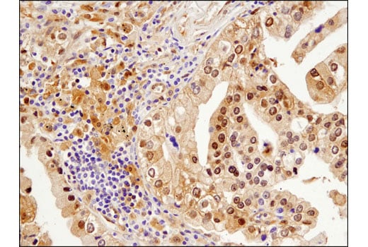 Immunohistochemistry Image 1: β-Arrestin 1 (D7Z3W) XP<sup>®</sup> Rabbit mAb