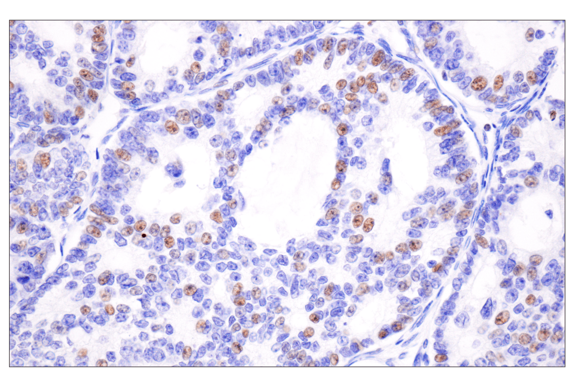 Immunohistochemistry Image 3: Acetyl-Histone H4 (Lys16) (E2B8W) Rabbit mAb