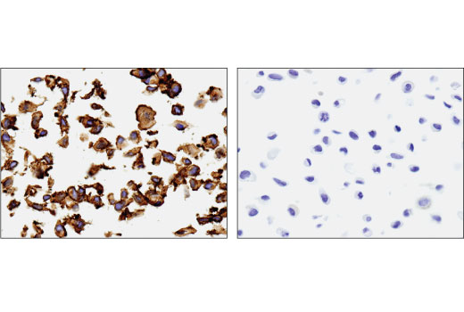 Immunohistochemistry Image 1: Mesothelin (D9R5G) XP<sup>®</sup> Rabbit mAb (BSA and Azide Free)