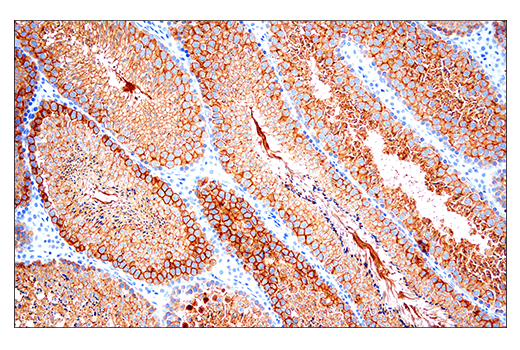 Immunohistochemistry Image 1: Ly6k (E4K8Y) XP<sup>®</sup> Rabbit mAb (BSA and Azide Free)