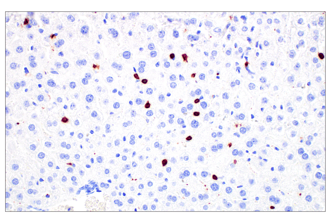 Immunohistochemistry Image 3: CD20 (E3N7O) XP<sup>®</sup> Rabbit mAb