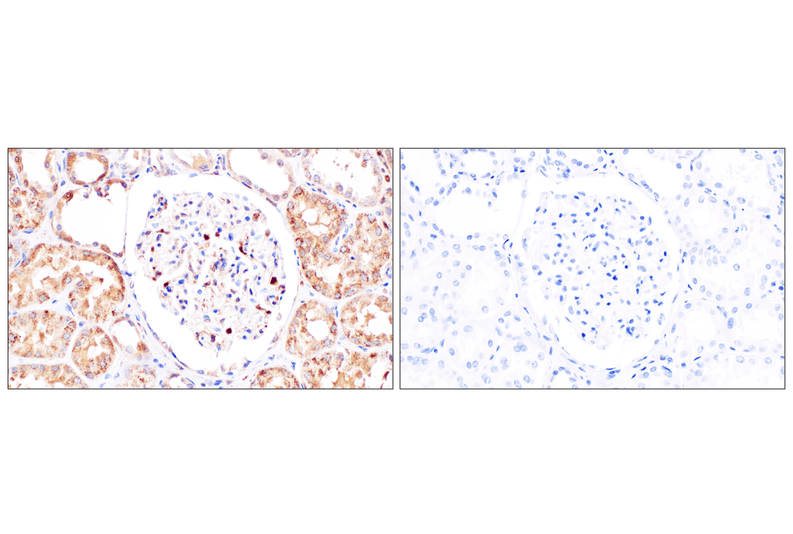 Immunohistochemistry Image 9: Catalase (D4P7B) XP<sup>®</sup> Rabbit mAb
