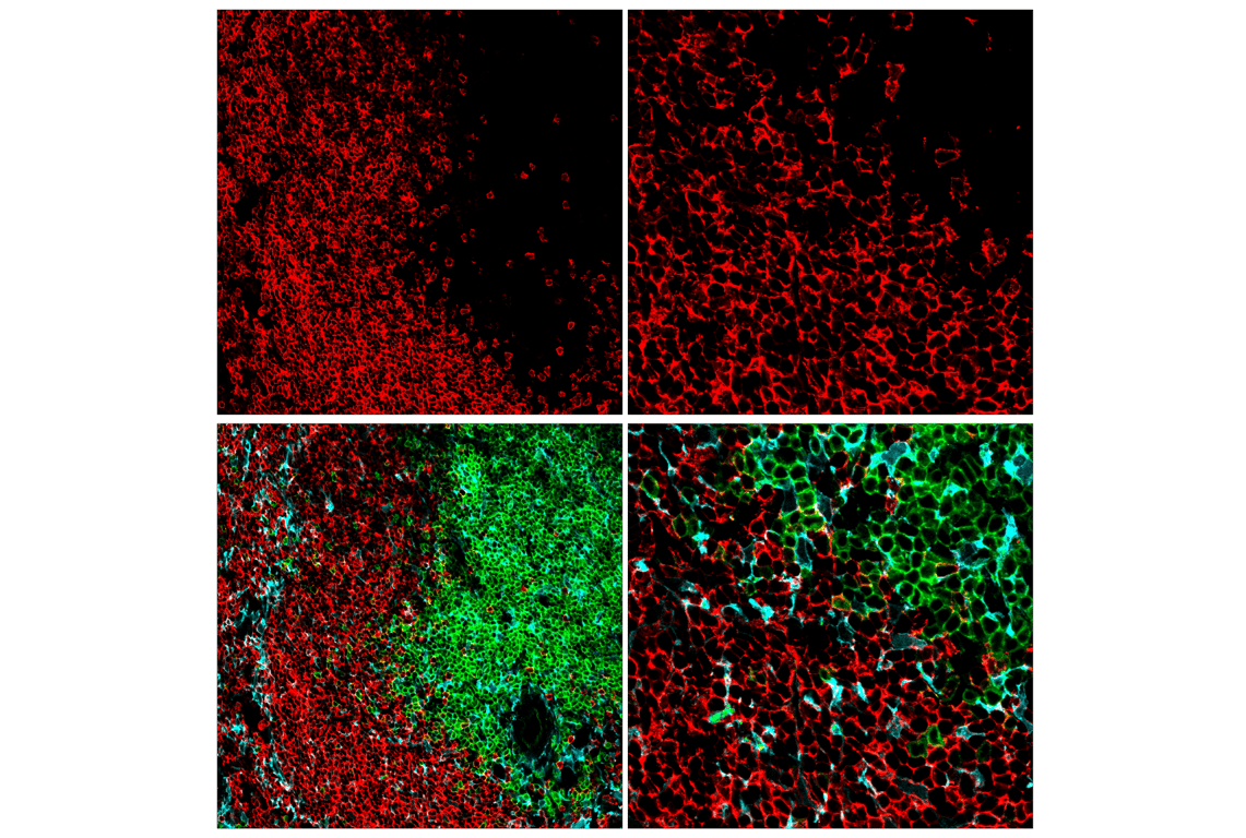 Immunofluorescence Image 1: CD20 (E3N7O) XP<sup>®</sup> Rabbit mAb (BSA and Azide Free)