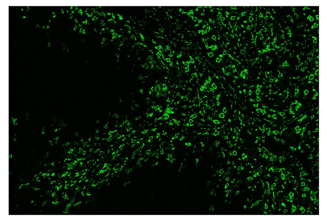 Immunohistochemistry Image 2: CD163 (D6U1J) & CO-0022-488 SignalStar<sup>™</sup> Oligo-Antibody Pair