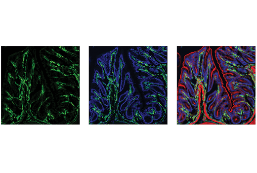 Immunofluorescence Image 1: VISTA (D5L5T) XP<sup>®</sup> Rabbit mAb