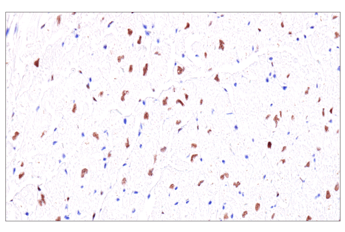 Immunohistochemistry Image 13: GATA-6 (D61E4) XP<sup>®</sup> Rabbit mAb (BSA and Azide Free)