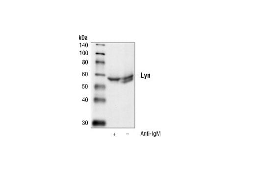 Western Blotting Image 1: Lyn Antibody