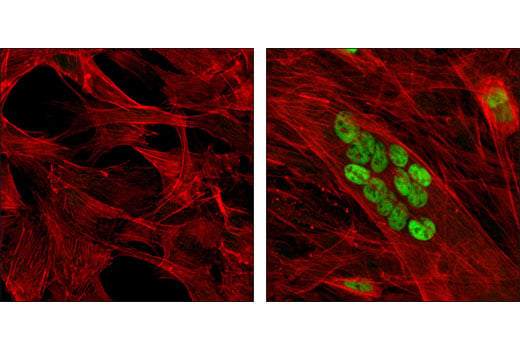 Immunofluorescence Image 1: MEF2C (D80C1) XP<sup>®</sup> Rabbit mAb