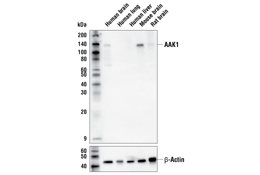 Western Blotting Image 1: AAK1 (E8M3P) Rabbit mAb