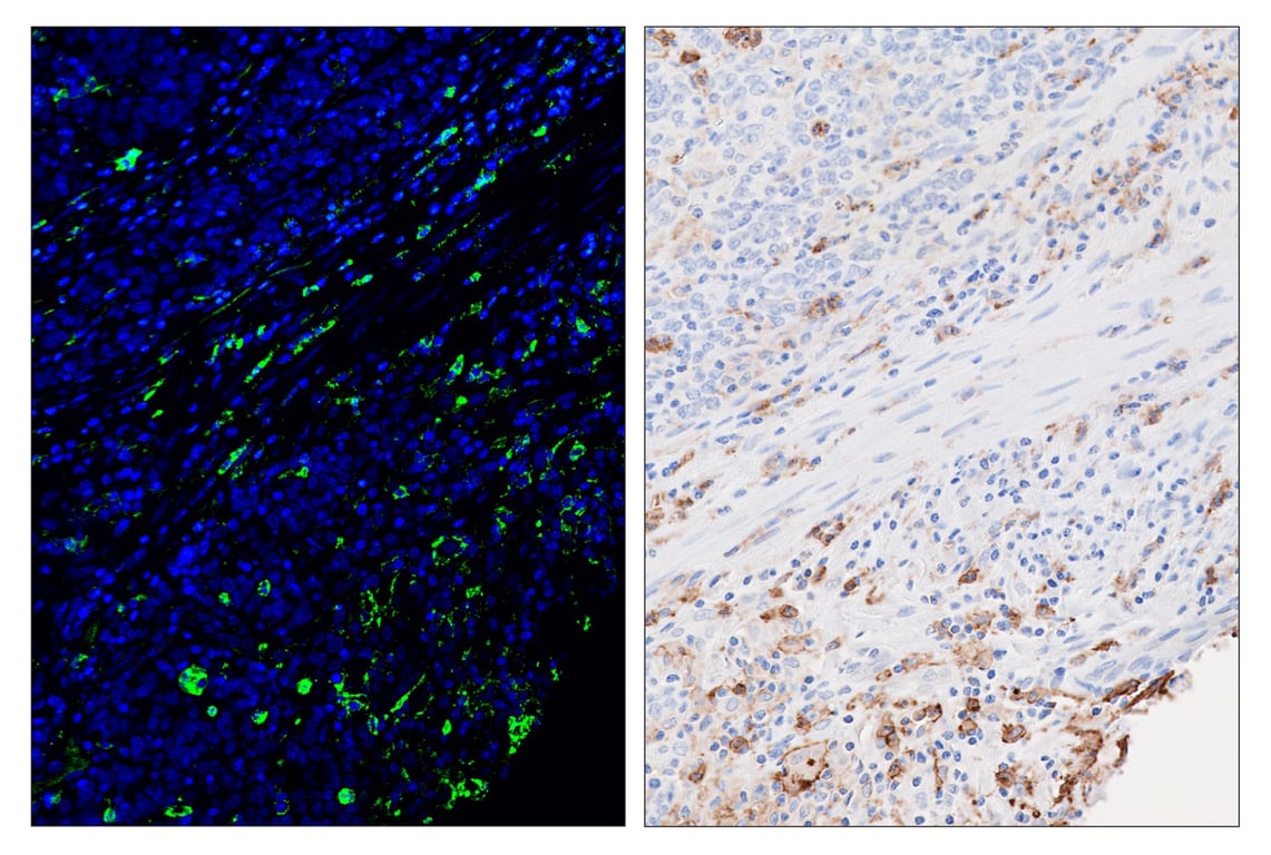 Immunohistochemistry Image 6: CD16 (D1N9L) & CO-0031-488 SignalStar<sup>™</sup> Oligo-Antibody Pair