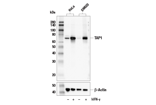undefined Image 8: MHC Class I Antigen Processing and Presentation Antibody Sampler Kit