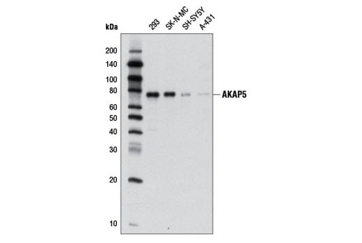 Western Blotting Image 1: AKAP5 (D28G3) Rabbit mAb