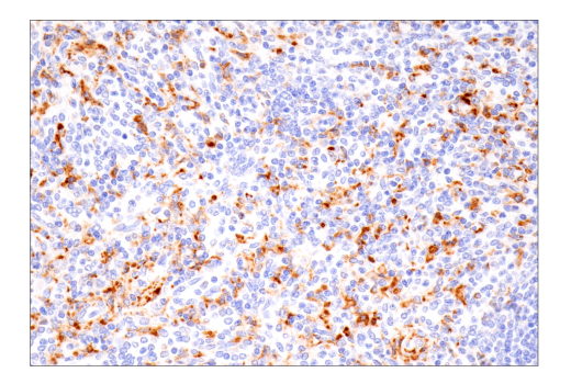 undefined Image 67: Microglia Neurodegeneration Module Antibody Sampler Kit