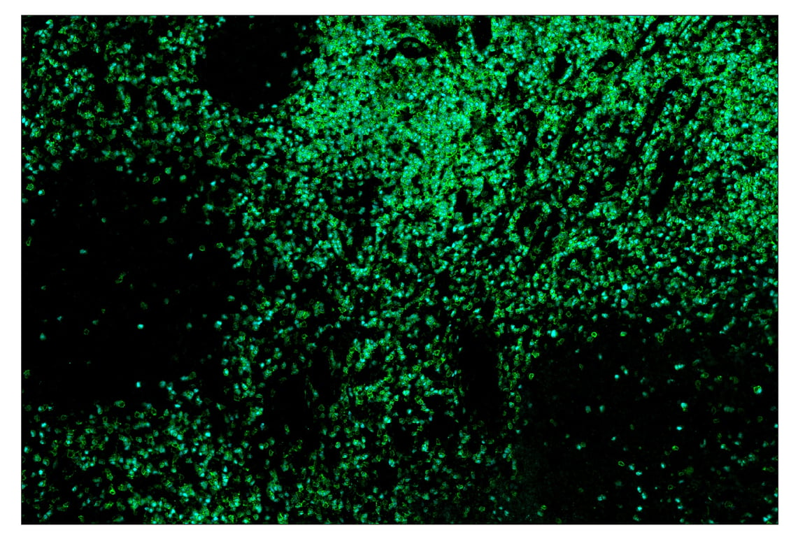 Immunohistochemistry Image 1: TCF1/TCF7 (C63D9) & CO-0006-488 SignalStar<sup>™</sup> Oligo-Antibody Pair