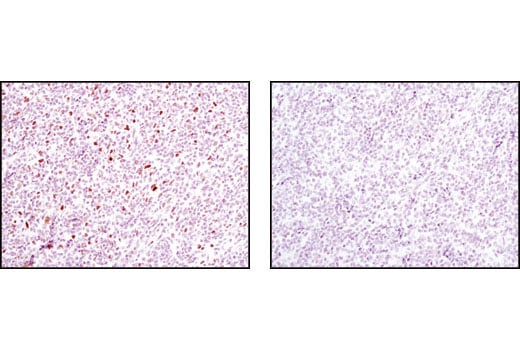 undefined Image 32: Human Reactive M1 vs M2 Macrophage IHC Antibody Sampler Kit