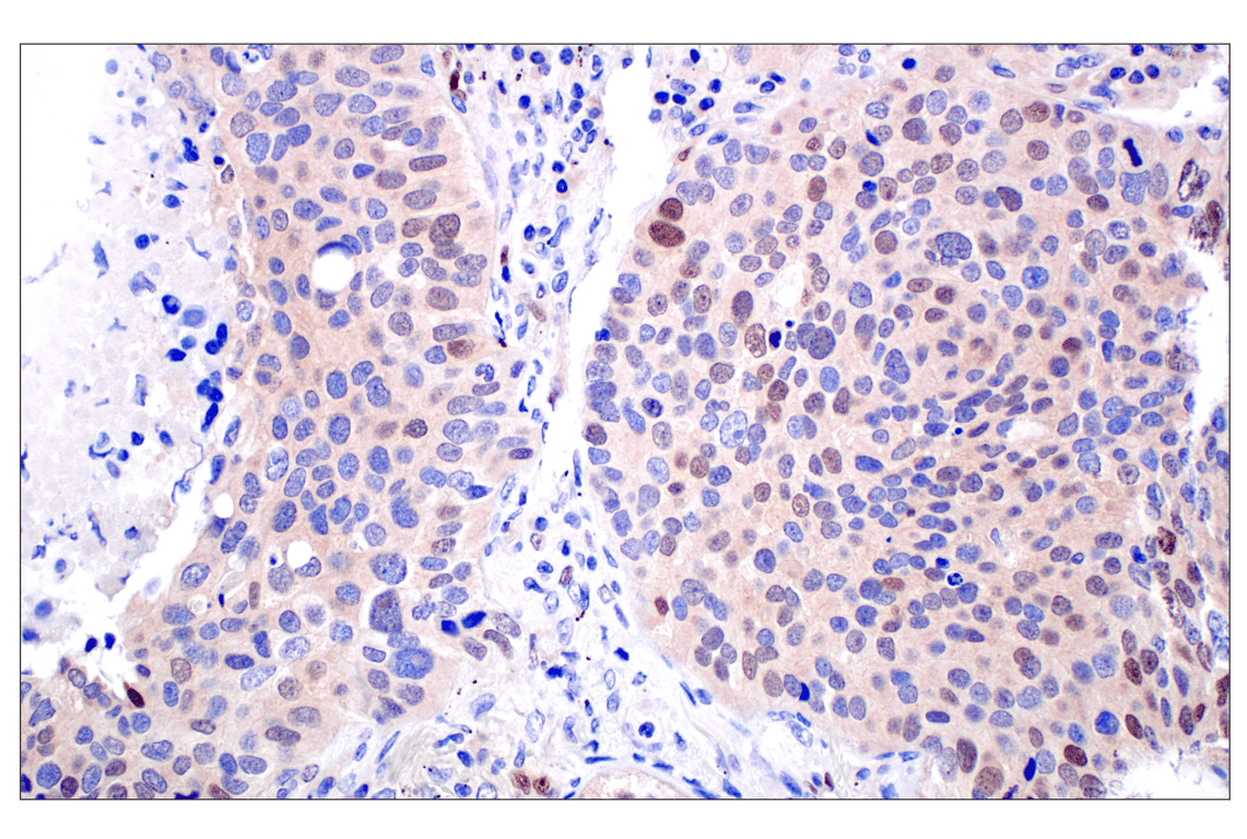 Immunohistochemistry Image 2: ID1 (F2M1J) Rabbit mAb (BSA and Azide Free)