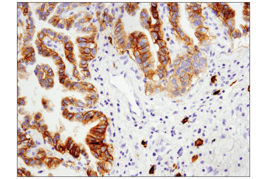 Immunohistochemistry Image 3: c-Kit (D3W6Y) XP<sup>®</sup> Rabbit mAb