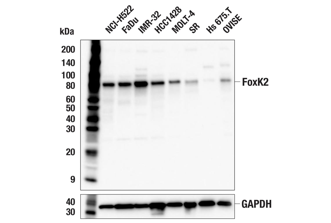 Western Blotting Image 2: FoxK2 (E7C5H) Rabbit mAb