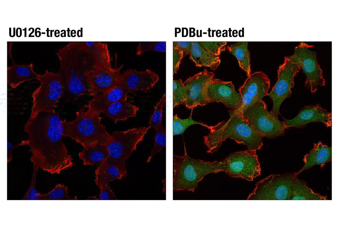undefined Image 69: Cannabinoid Receptor 1 Downstream Signaling Antibody Sampler Kit